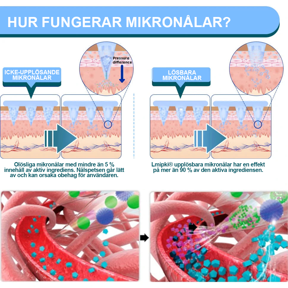 SE officiell butik: Lmipki®NIDDK-Tirzepatide Nanometer Microneedling Patch(Balansera blodsockret, smärtfritt, utan biverkningar.lämplig för fetma och diabetes.)🔄